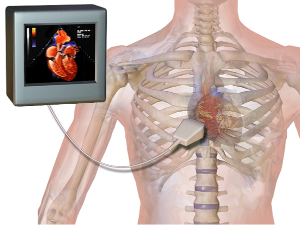 Unterschied zwischen EKG und Echokardiogramm