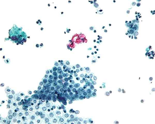 Perbedaan antara endotelium dan mesothelium