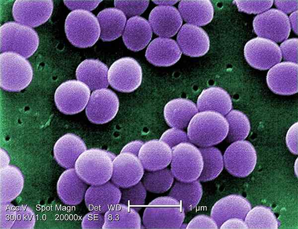 Diferencia entre epidermidis y aureus