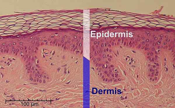 Perbezaan antara epidermis dan dermis
