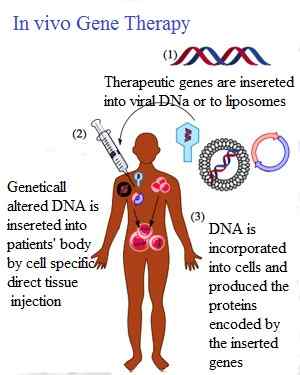 Diferencia entre la terapia génica ex vivo y in vivo