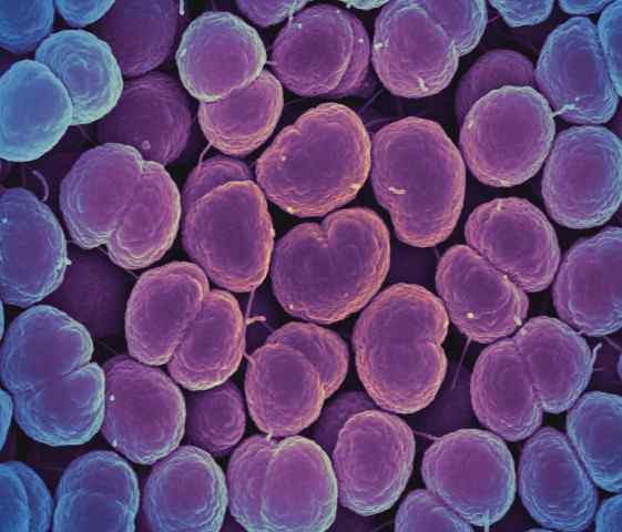 Différence entre les bactéries fastidieuses et non fastides