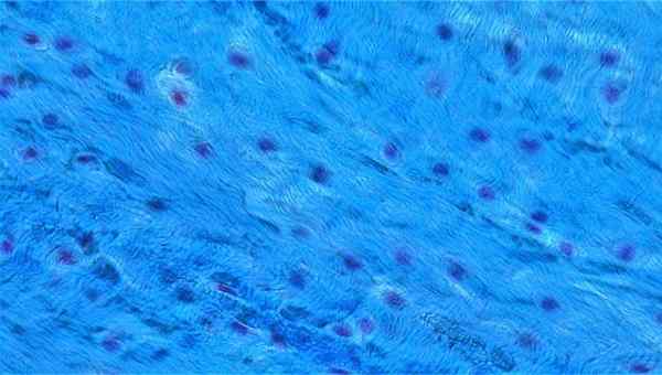 Unterschied zwischen Fibrocartilage und hyaline Knorpel