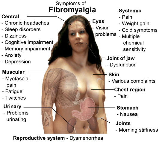 Différence entre la fibromyalgie et l'arthrite