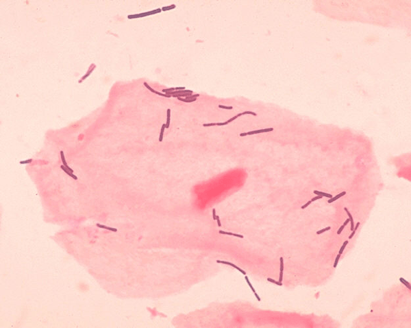 Unterschied zwischen GABA und Pharmagaba