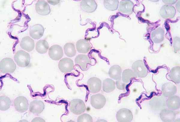 Diferencia entre Giemsa Stain y Wright Stain