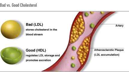 Unterschied zwischen gutem Cholesterinspiegel und schlechtem Cholesterin