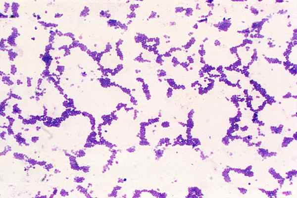 Diferencia entre bacterias Gram positivas y Gram negativas