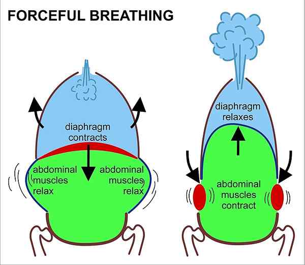 Diferencia entre hiperventilación y taquipnea