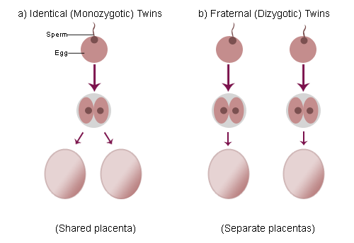 Différence entre les jumeaux identiques et fraternels