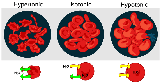 Perbedaan antara isotonik dan hipertonik