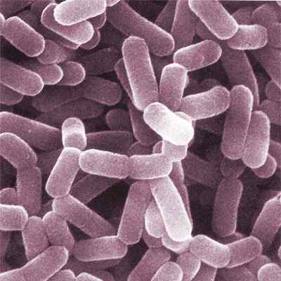 Unterschied zwischen Lactobacillus und Bifidobacterium