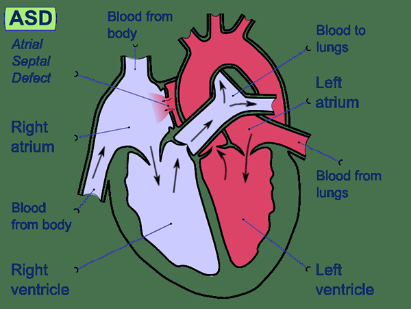 Diferencia entre el lado izquierdo y el derecho del corazón