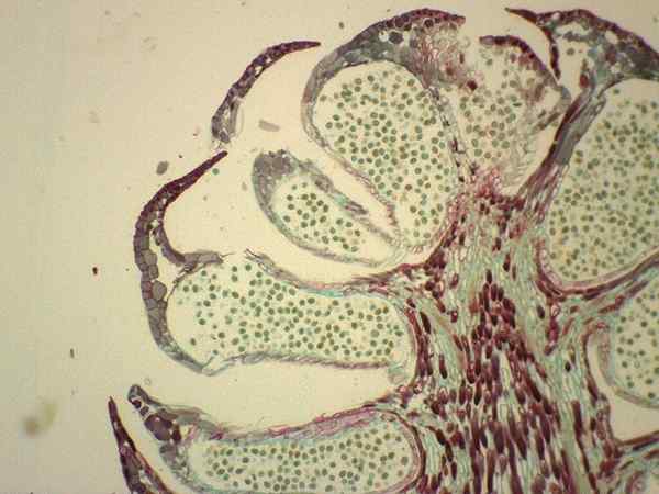 Différence entre les gamétophytes masculins et féminins