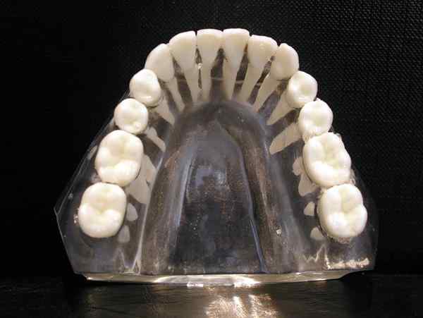 Perbezaan antara molar maxillary dan mandibular