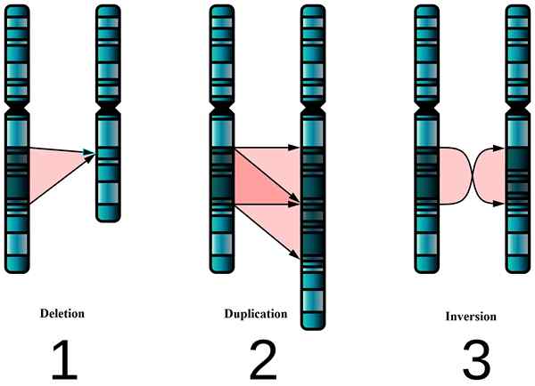 Différence entre les troubles mendéliens et chromosomiques