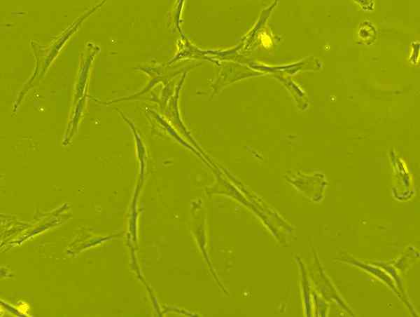 Diferencia entre las células madre mesenquimales y hematopoyéticas