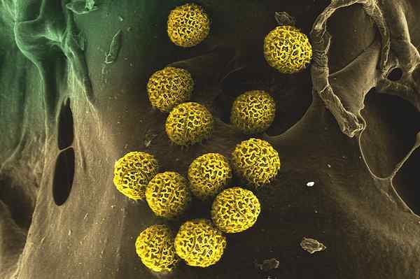 Unterschied zwischen Mikrosporien und Pollenkorn