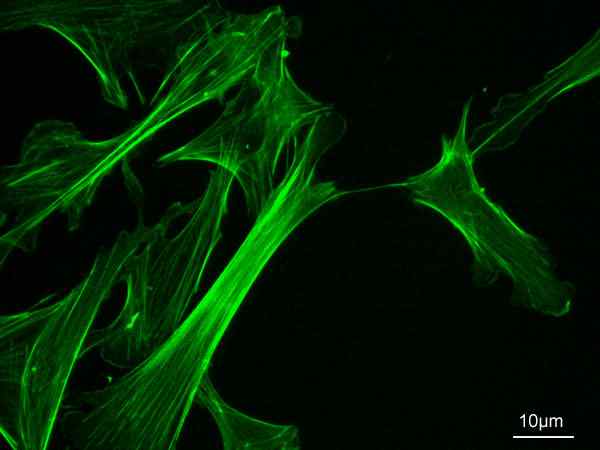 Perbezaan antara microtubules dan mikrofilam