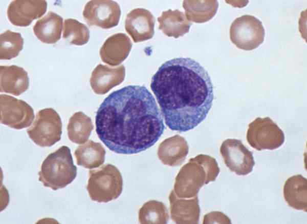 Différence entre le monocyte et les macrophages