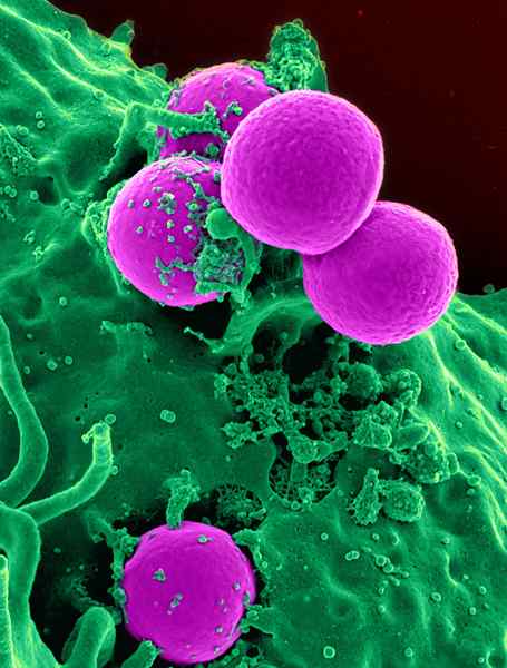 Perbezaan antara MRSA dan MSSA