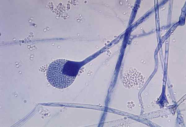 Unterschied zwischen Mucor und Rhizopus