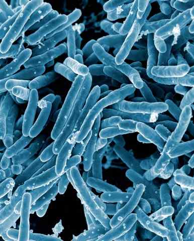 Diferencia entre Mycoplasma y Mycobacterium