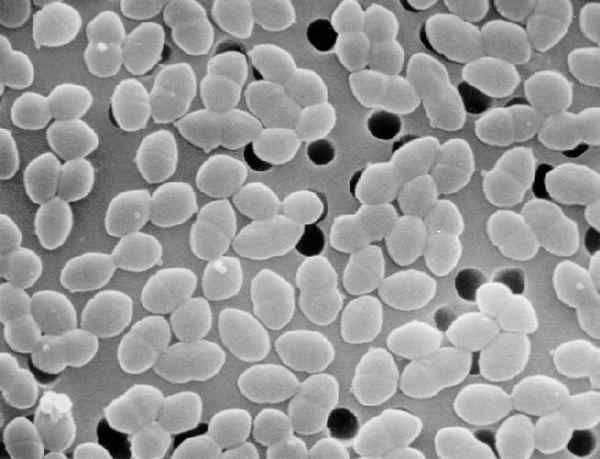 Diferencia entre la infección adquirida en nosocomial y la comunidad