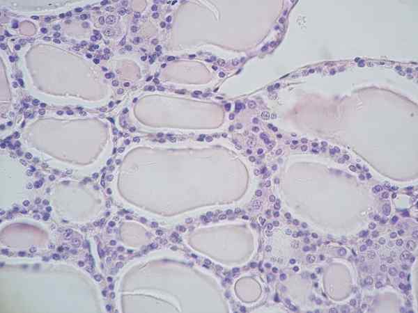 Diferencia entre las células parafoliculares y foliculares
