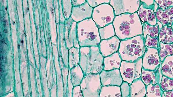 Différence entre le parenchyme et les cellules mésenchymateuses