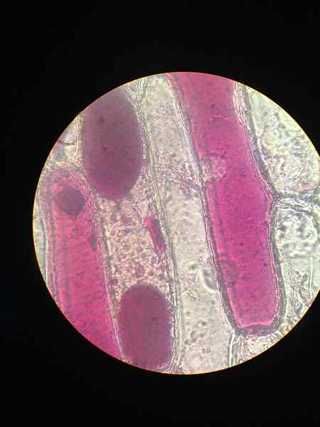 Perbezaan antara plasmolisis dan deplasmolisis