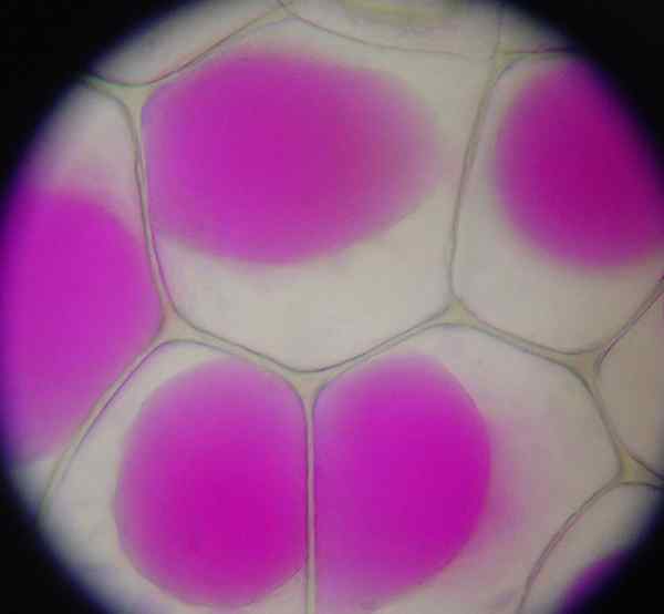 Perbedaan antara plasmolisis dan kekeruhan