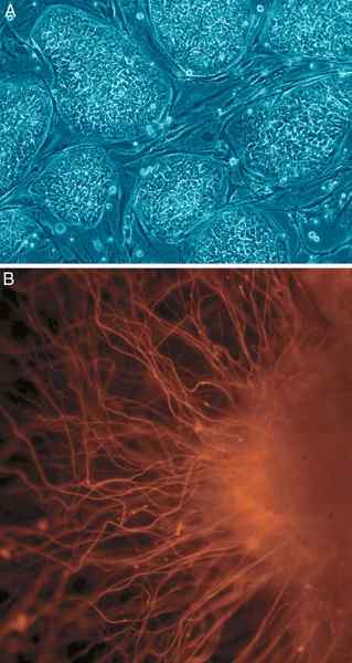 Différence entre les cellules souches pluripotentes et multipotentes