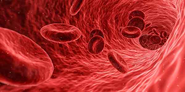 Unterschied zwischen Polyzythämie und Erythrozytose