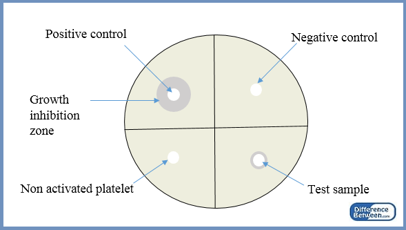 Différence entre le contrôle positif et négatif