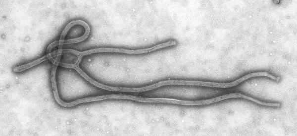 Différence entre le virus de l'ARN sens positif et négatif