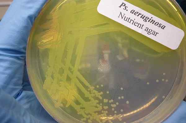 Diferencia entre Pseudomonas aeruginosa y Enterobacteriaceae