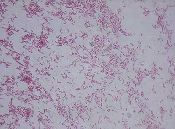 Différence entre Pseudomonas aeruginosa et pseudomonas fluorescens