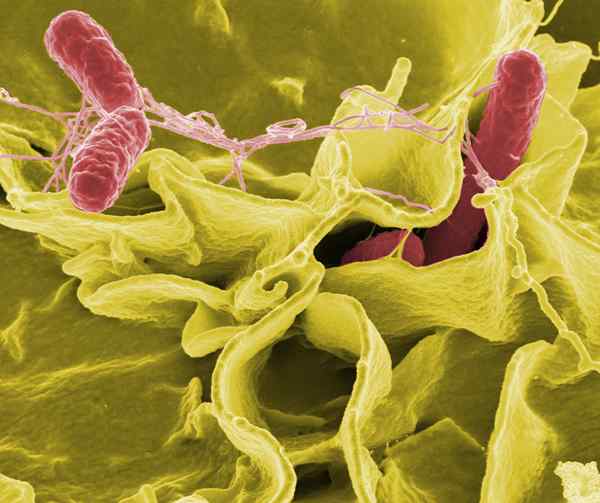 Perbezaan antara Salmonella Typhi dan Paratyphi
