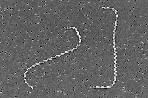 Diferencia entre espirilla y espiroquetas