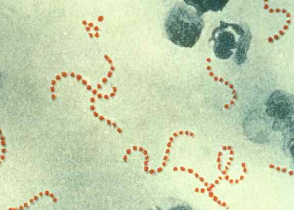 Différence entre Strep A et Strep B