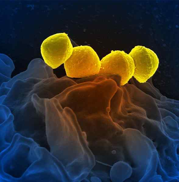 Différence entre la streptolysine O et la streptolysine S