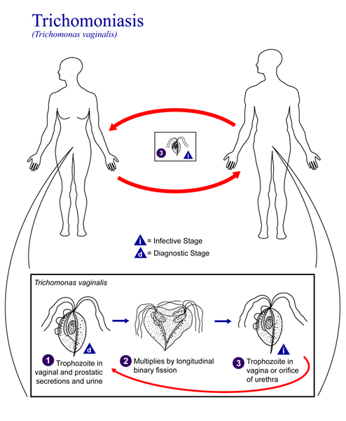 Unterschied zwischen Trichomoniasis und BV