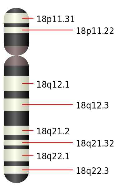 Différence entre la trisomie 13 et 18