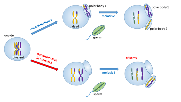 Perbezaan antara trisomi dan triploidy