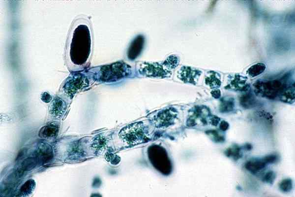 Perbezaan antara sporangia unilocular dan plurilocular