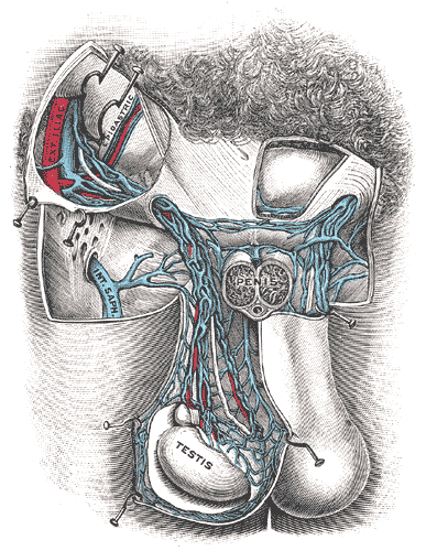 Perbezaan antara varicocele dan kanser testis