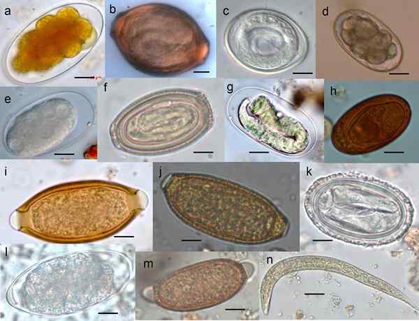 Différence entre les vers et les parasites