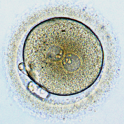 Différence entre zoospore et zygote