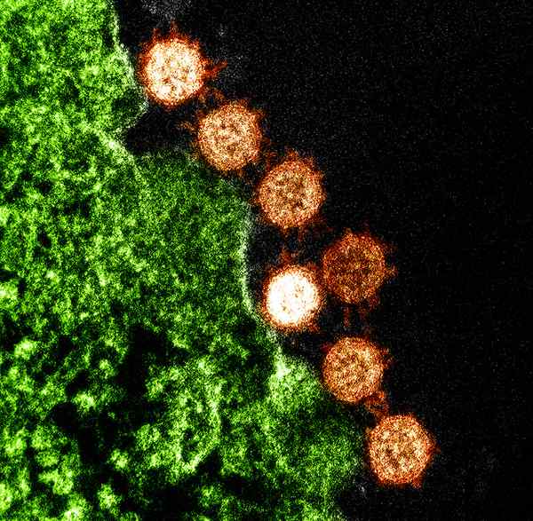 Unterschiede zwischen DNA- und RNA -Viren